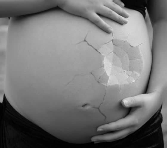 Miscarriage cost Bangalore 2019 - Select IVF India