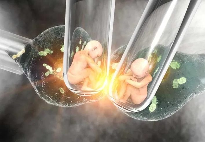 Test Tube Baby Cost Hyderabad